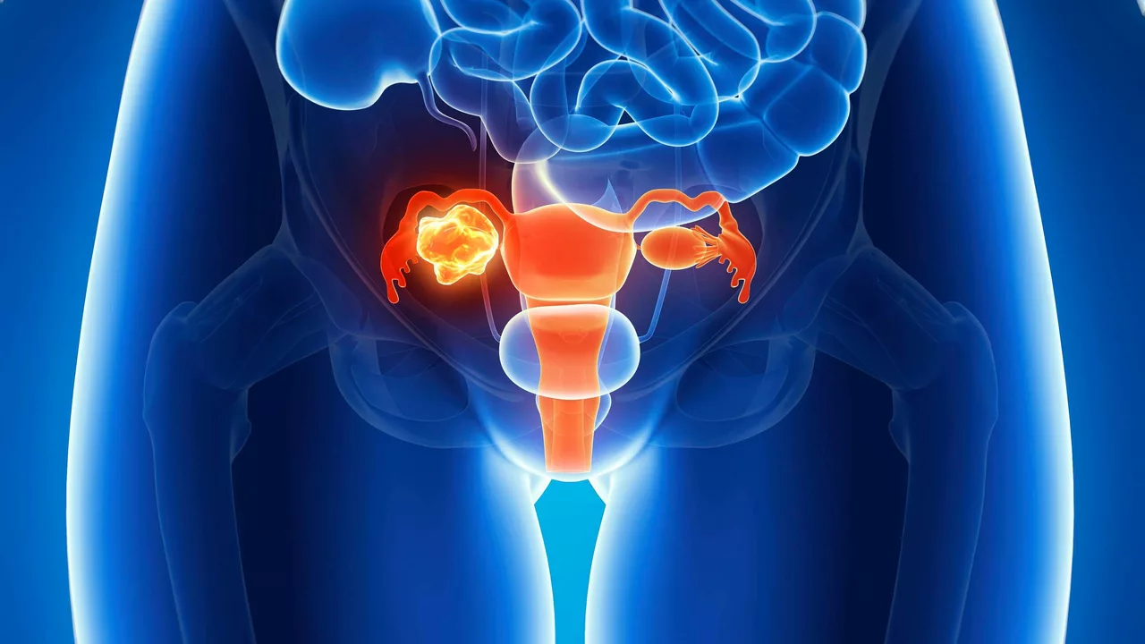 Coping with an Ovarian Cancer Diagnosis: Tips for Emotional Support